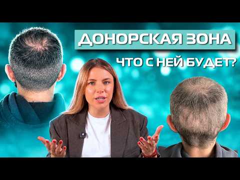 Пересадка волос: почему нельзя просто взять и пересадить максимум графтов?